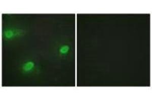 Immunofluorescence analysis of HeLa cells, using CSTF2 antibody. (CSTF2 抗体  (N-Term))