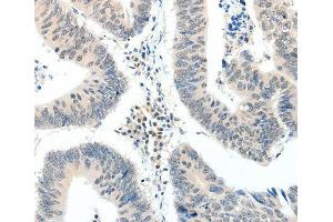 Immunohistochemistry (IHC) image for anti-TNF Receptor-Associated Factor 7 (TRAF7) antibody (ABIN3023478) (TRAF7 抗体)