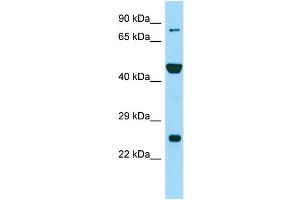 Western Blotting (WB) image for anti-Peptidyl Arginine Deiminase, Type VI (PADI6) (N-Term) antibody (ABIN2790272) (PADI6 抗体  (N-Term))