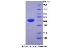 SDS-PAGE analysis of Human HSPb2 Protein. (HSPB2 蛋白)