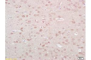 Formalin-fixed and paraffin embedded rat brain labeled with Anti-NKA/Neurokinin A Polyclonal Antibody, Unconjugated (ABIN724445) at 1:200 followed by conjugation to the secondary antibody and DAB staining (NKA 抗体  (AA 98-107))
