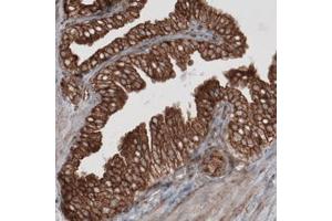 Immunohistochemical staining (Formalin-fixed paraffin-embedded sections) of human prostate with HSP90B1 monoclonal antibody, clone CL2647  shows strong cytoplasmic immunoreactivity in glandular cells. (GRP94 抗体)