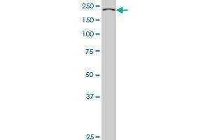 KNTC1 monoclonal antibody (M01), clone 10H4 Western Blot analysis of KNTC1 expression in Hela S3 NE . (KNTC1 抗体  (AA 2100-2209))
