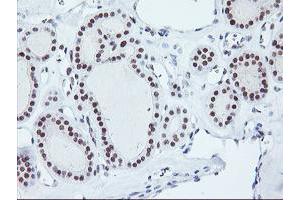 Image no. 5 for anti-Ring Finger Protein 113B (RNF113B) antibody (ABIN1500718) (RNF113B 抗体)