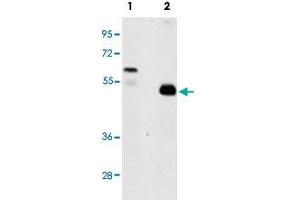Western blot analysis of TRAF2 (arrow) using rabbit TRAF2 polyclonal antibody . (TRAF2 抗体  (C-Term))