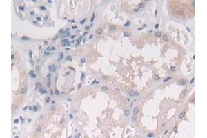 DAB staining on IHC-P; Samples: Human Kidney Tissue (IL-25 抗体  (AA 28-177))