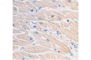Immunohistochemical staining of human heart tissue using MYD88 polyclonal antibody  at 2 ug/mL . (MYD88 抗体  (AA 233-248))