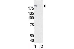 Western blot analysis of phospho-EGFR antibody and HeLa cell lysate, either induced (Lane 1) or noninduced with EGF (2). (EGFR 抗体  (pTyr1172))