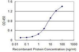 Detection limit for recombinant GST tagged AAK1 is 0. (AAK1 抗体  (AA 315-415))