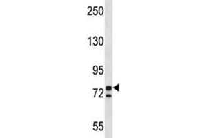 PCSK7 antibody western blot analysis in K562 lysate. (PCSK7 抗体  (AA 692-721))