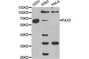 Western blot analysis of extracts of various cell lines, using PAX3 antibody. (Paired Box 3 抗体)