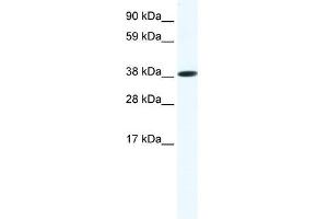 Western Blot showing OBOX6 antibody used at a concentration of 1-2 ug/ml to detect its target protein. (OBOX6 抗体  (Middle Region))