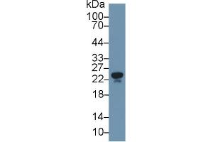 Western Blot; Sample: Human Serum; Primary Ab: 1µg/ml Rabbit Anti-Human APOM Antibody Second Ab: 0. (Apolipoprotein M 抗体  (AA 8-188))