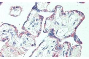 Immunohistochemistry (IHC) image for anti-Coagulation Factor V (F5) (AA 364-611) antibody (ABIN7438925)