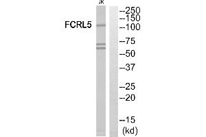 Western blot analysis of extracts from Jurkat cells, using FCRL5 antibody. (FCRL5 抗体  (Internal Region))