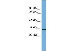 WB Suggested Anti-C20orf201 Antibody Titration: 0. (C20orf201 抗体  (C-Term))