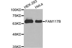 Western Blotting (WB) image for anti-Family with Sequence Similarity 117, Member B (FAM117B) antibody (ABIN1875633) (FAM117B 抗体)