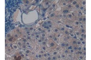 Immunohistochemistry (IHC) image for anti-Synuclein, gamma (Breast Cancer-Specific Protein 1) (SNCG) (AA 1-121) antibody (ABIN7429343)