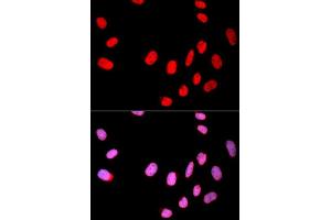 Immunofluorescence analysis of U2OS cell using CDC25C antibody. (CDC25C 抗体  (AA 174-473))