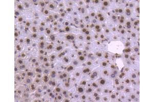 Paraformaldehyde-fixed, paraffin embedded mouse liver, Antigen retrieval by boiling in sodium citrate buffer (pH6) for 15min, Block endogenous peroxidase by 3% hydrogen peroxide for 30 minutes, Blocking buffer (normal serum) at 37°C for 20min, Antibody incubation with Histone H2B (3A6) Monoclonal Antibody  at 1:50 overnight at 4°C, followed by a conjugated secondary and DAB staining. (Histone H2B 抗体)