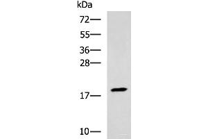 Western blot analysis of Human muscle tissue lysate using TNNC2 Polyclonal Antibody at dilution of 1:400 (TNNC2 抗体)