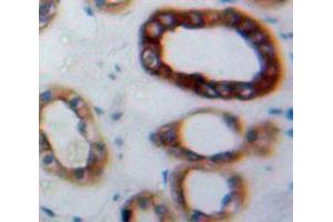 Used in DAB staining on fromalin fixed paraffin-embedded Kidney tissue (HBEGF 抗体  (AA 25-160))
