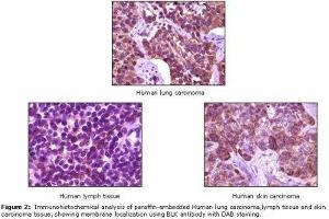 Image no. 1 for anti-B Lymphoid Tyrosine Kinase (BLK) antibody (ABIN232111) (BLK 抗体)