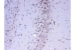 IHC testing of FFPE mouse brain tissue with MED4 antibody at 1ug/ml. (MED4 抗体)