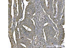 IHC analysis of PARK7/DJ1 using anti-PARK7/DJ1 antibody (ABIN7600468). (PARK7/DJ1 抗体  (AA 2-189))