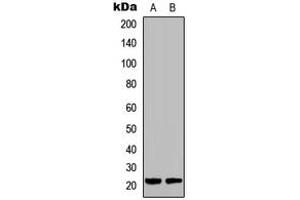 Western blot analysis of DUSP22 expression in HCT116 (A), Raw264. (DUSP22 抗体  (Center))