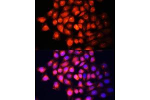 Immunofluorescence analysis of HeLa cells using IGF2 Polyclonal Antibody (ABIN6130483, ABIN6142237, ABIN6142238 and ABIN6218206) at dilution of 1:100 (40x lens). (IGF2 抗体  (AA 25-180))