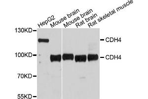 Western blot analysis of extracts of various cell lines, using CDH4 antibody. (Cadherin 4 抗体)