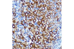 Immunohistochemistry of paraffin-embedded Rat ovary using WWC1 Rabbit pAb (ABIN7271388) at dilution of 1:100 (40x lens).