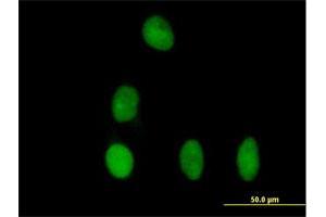 Immunofluorescence of purified MaxPab antibody to DBR1 on HeLa cell. (DBR1 抗体  (AA 1-544))