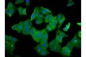Immunofluorescence staining of HepG2 cells with ABIN7161592 at 1:100, counter-stained with DAPI. (QPRT 抗体  (AA 113-254))