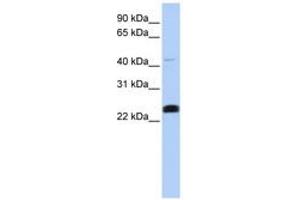 Image no. 1 for anti-Lysocardiolipin Acyltransferase 1 (LCLAT1) (C-Term) antibody (ABIN6743300) (LCLAT1 抗体  (C-Term))