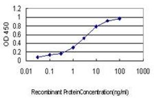 Detection limit for recombinant GST tagged CETN1 is approximately 0. (Centrin 1 抗体  (AA 1-100))