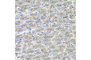 Immunohistochemistry of paraffin-embedded mouse stomach using STXBP2 antibody at dilution of 1:100 (x40 lens). (STXBP2 抗体)