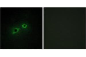 Immunofluorescence analysis of HepG2 cells, using ENTK Antibody. (TMPRSS15 抗体  (AA 81-130))