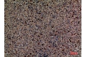 Immunohistochemical analysis of paraffin-embedded human-spleen, antibody was diluted at 1:100. (CD58 抗体  (Internal Region))