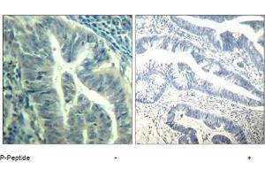 Image no. 3 for anti-Cyclin-Dependent Kinase 6 (CDK6) (pTyr24) antibody (ABIN319290) (CDK6 抗体  (pTyr24))