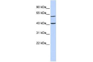 TCTN3 antibody used at 1 ug/ml to detect target protein. (TCTN3 抗体  (Middle Region))