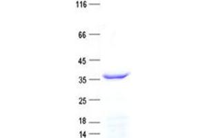 Western Blotting (WB) image for RAD9-HUS1-RAD1 Interacting Nuclear Orphan 1 (RHNO1) protein (His tag) (ABIN2714044)