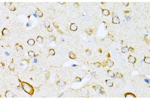 Immunohistochemistry of paraffin-embedded Mouse brain using VARS Polyclonal Antibody at dilution of 1:100 (40x lens). (VARS 抗体)