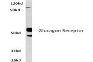 Image no. 1 for anti-Glucagon Receptor (GCGR) antibody (ABIN317704) (Glucagon Receptor 抗体)