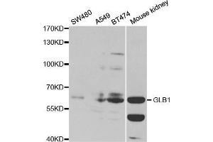 Western blot analysis of extracts of various cell lines, using GLB1 antibody.