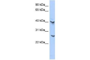 ATP6V0E2 antibody used at 1 ug/ml to detect target protein. (ATP6V0E2 抗体  (Middle Region))