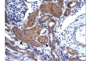 Image no. 1 for anti-IKAROS Family Zinc Finger 2 (IKZF2) (AA 396-445) antibody (ABIN203095) (IKZF2 抗体  (AA 396-445))