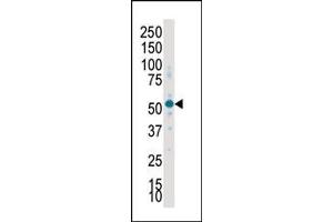 Western Blotting (WB) image for anti-serum/glucocorticoid Regulated Kinase 2 (SGK2) (AA 395-426), (C-Term) antibody (ABIN392461)