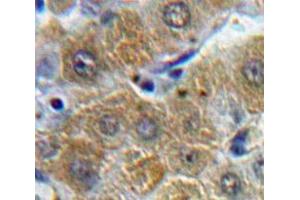 #VALUE! (ORM1 抗体  (AA 19-201))